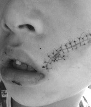 ���b�ɘ�(l��)������_(k��i)��˲�g��ը �к�Ę��ը��