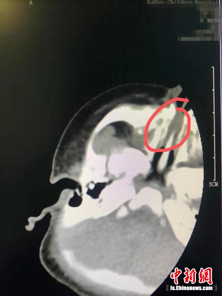 ����CT�z��Y(ji��)�����ޫk �z